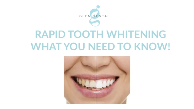 Brighten Your Smile with Crest Whitening Strips: Unveiling the Secrets to a Dazzling Smile