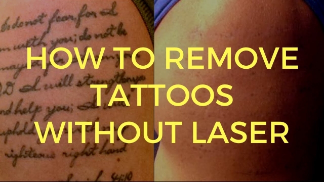 New Tattoo Ink Makes Removal Easier