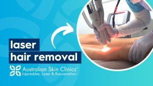 Smooth and Carefree: Unveiling the Magic of Laser Hair Removal